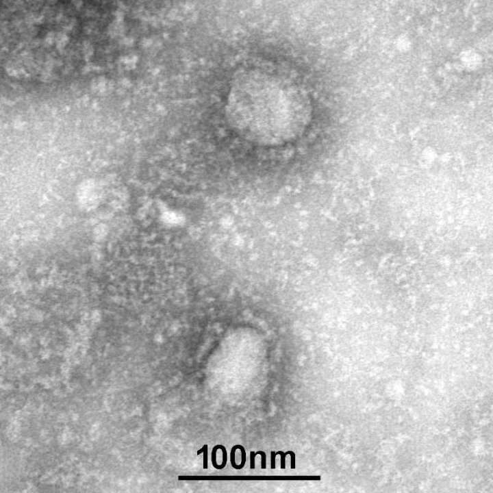 新型コロナウイルス＿顕微鏡写真